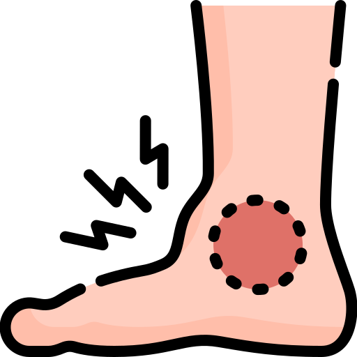 Ankle Arthroscopy Treatment