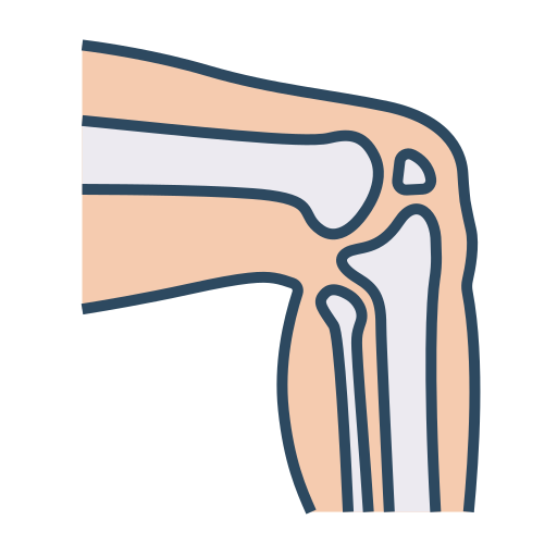 Knee Replacement Surgery